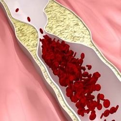 ما حقيقة الكوليسترول ؟؟